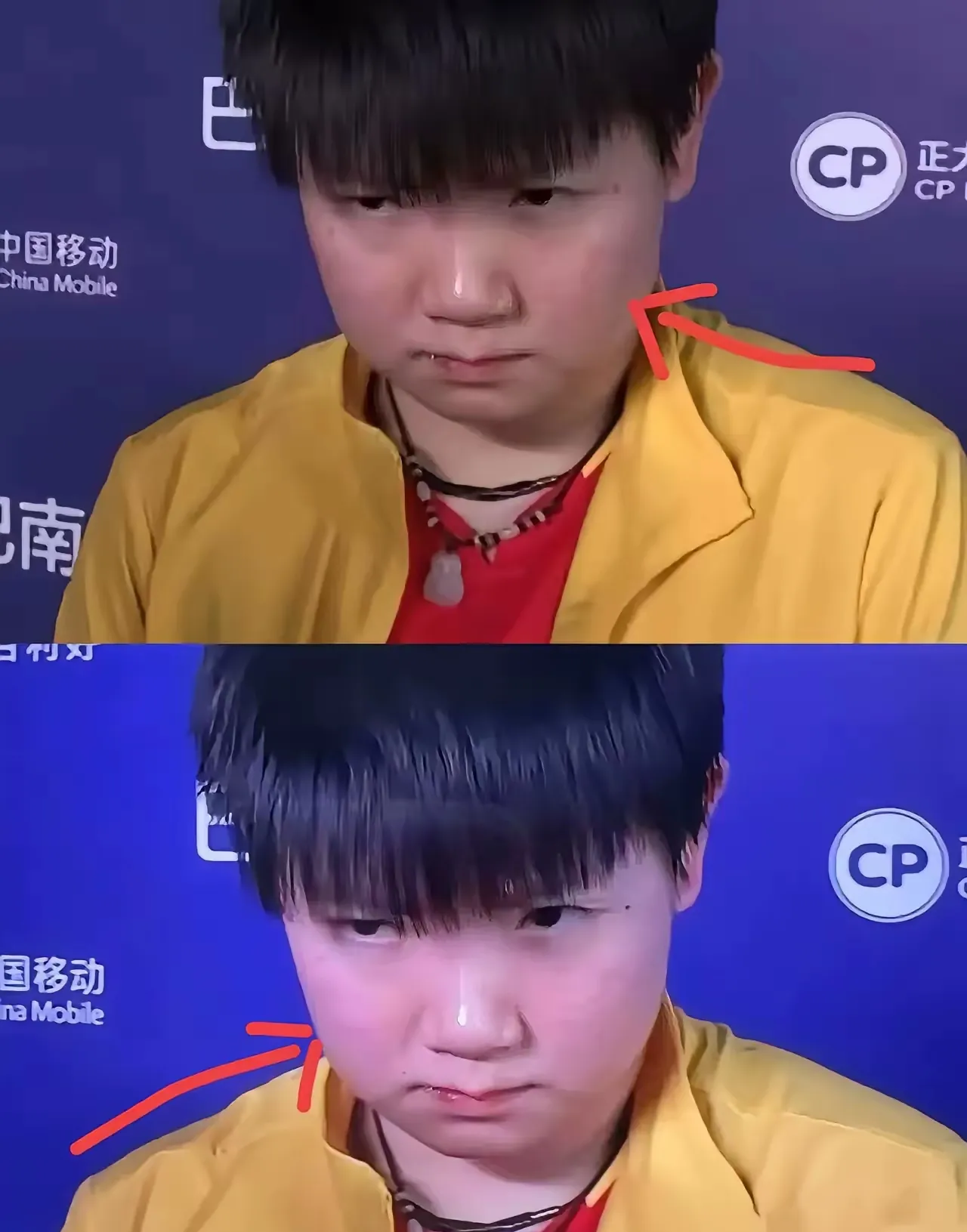 关于巴黎在比赛中受伤退赛，孙颖莎主帅表示担忧的信息